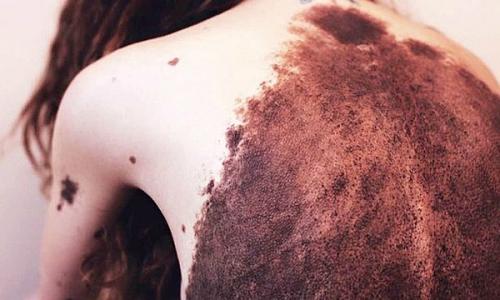 Vấn đề của hệ tim mạch