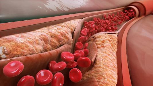 Dấu hiệu trên mặt cho thấy cholesterol 