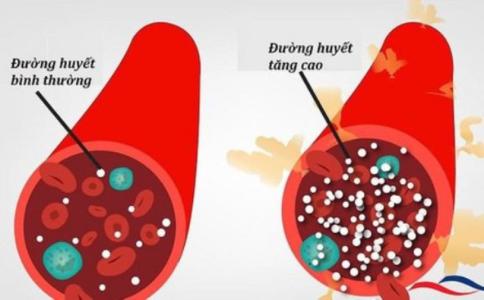 Kiểm soát đường huyết như thế nào?
