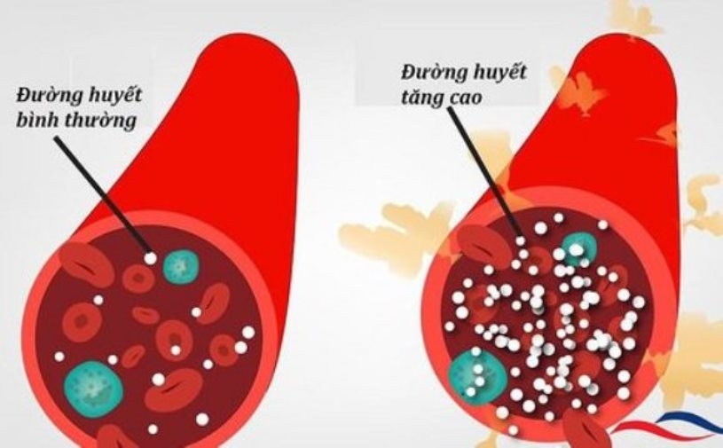 Trong máu luôn có một lượng đường nhất định, nếu lượng đường này thường xuyên cao sẽ dẫn tới bệnh đái tháo đường