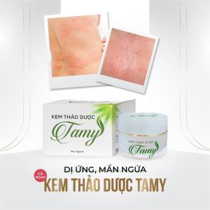Nhận diện các bệnh ngoài da thường gặp và cách phòng ngừa
