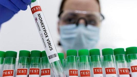 Malaysia xác nhận ca nhiễm đậu mùa khỉ đầu tiên