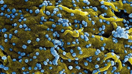 WHO tuyên bố đợt bùng phát loại virus mới