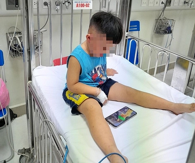 Bé trai nghi bị nhốt trong tủ cấp đông, nhập viện trong tình trạng suy hô hấp, hạ thân nhiệt - Ảnh: Bác sĩ cung cấp