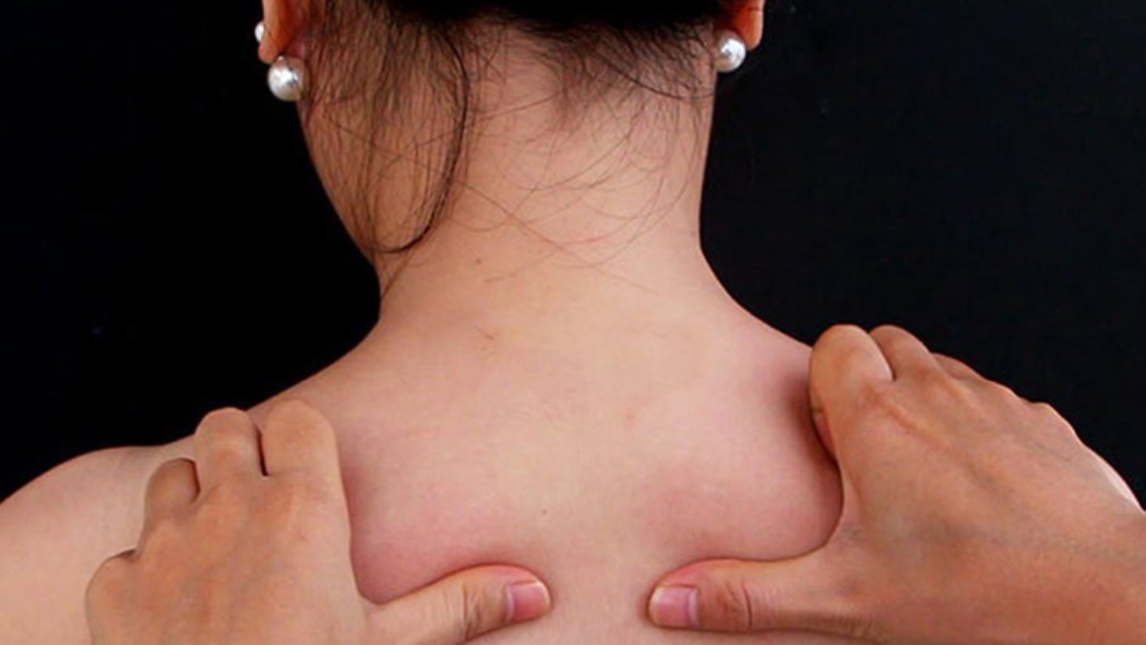 Ngón cái tác động lực vừa phải giúp gân cơ vùng vai gáy thư giãn, dễ chịu