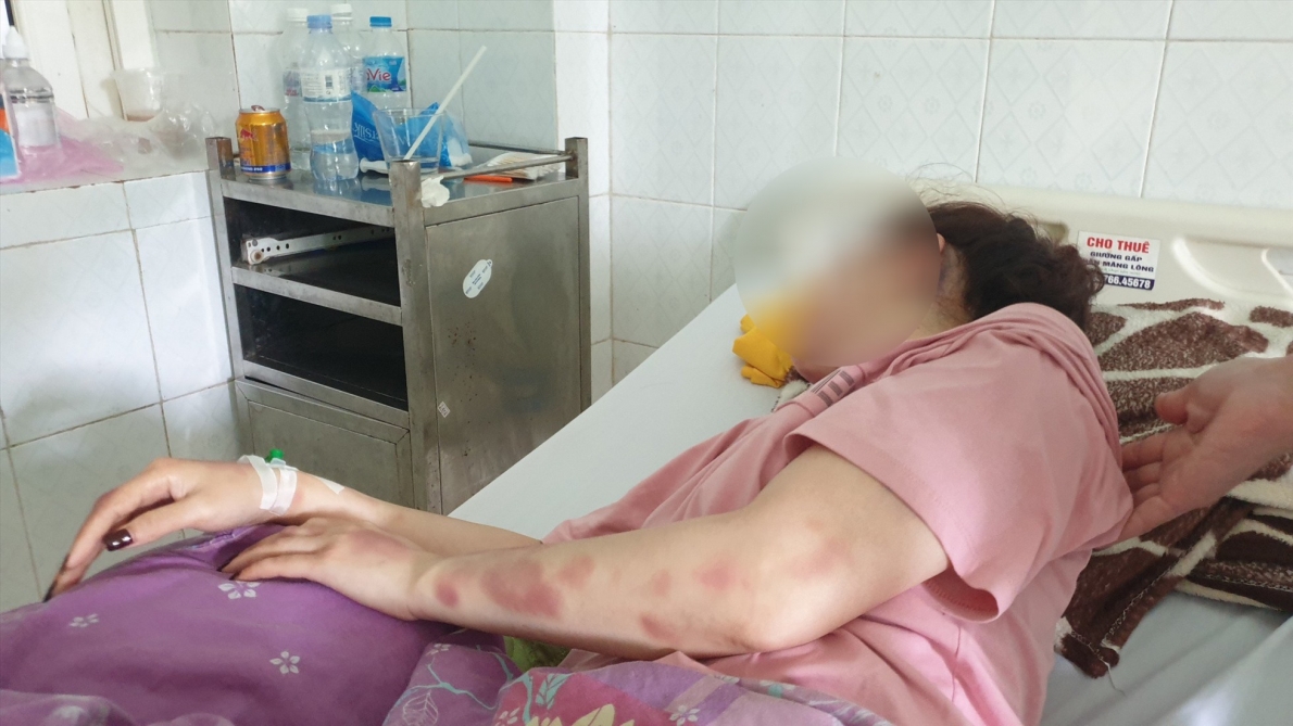 chị N.T.V. phải nhập viện điều trị ở Bệnh viện Đa khoa tỉnh Thanh Hóa. Ảnh: Q.D