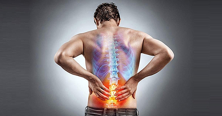 Điều trị và phòng ngừa đau thắt lưng