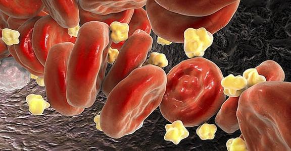 Hiểu thêm về cholesterol…