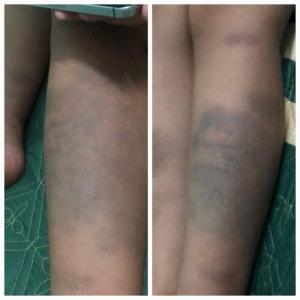 Đà Nẵng: Tạm đình chỉ đứng lớp cô giáo để học sinh bị bạo hành