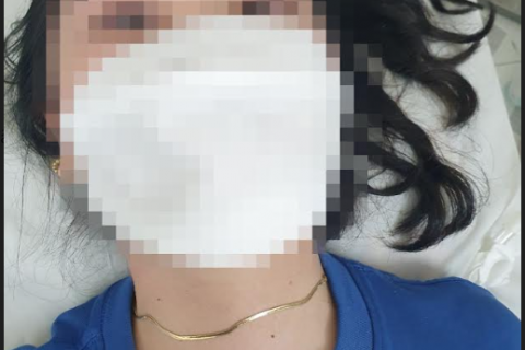 Cắt bỏ khối u bít tắc khí quản bằng kỹ thuật nội soi, kịp thời cứu sống bệnh nhân